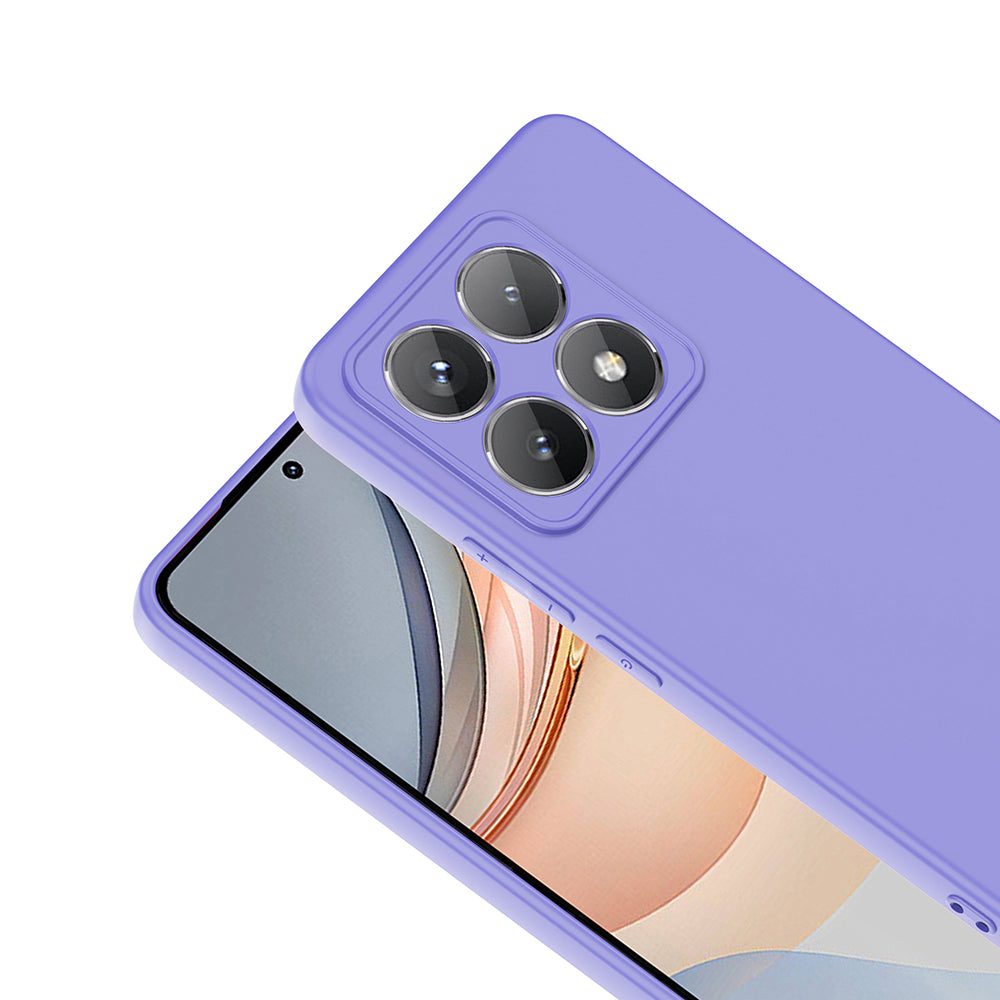 Xiaomi 14T Kılıf Zore Mara Lansman Kılıf