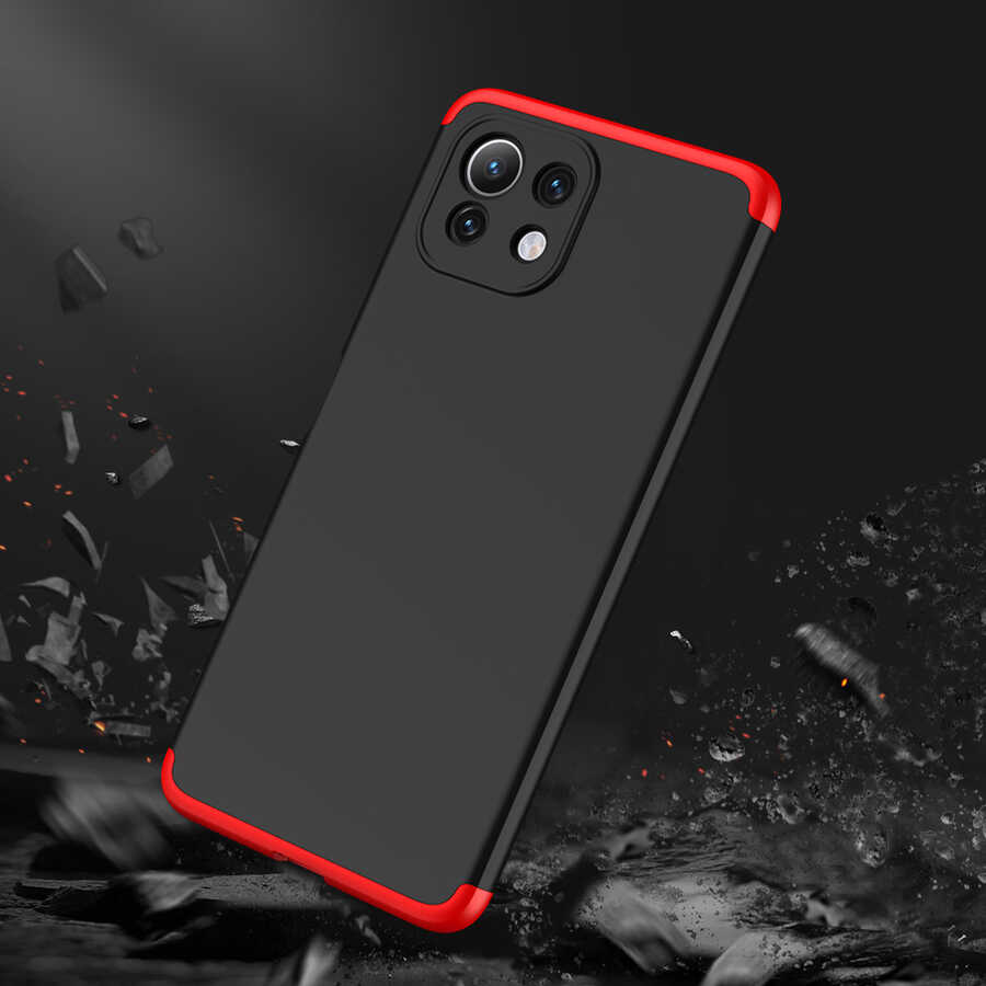 Xiaomi Mi 11 Lite Kılıf Zore Ays Kılıf