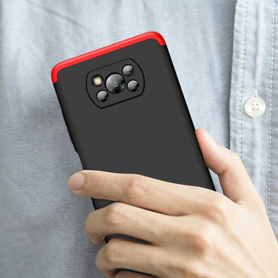 Xiaomi Poco X3 Kılıf Zore Ays Kılıf
