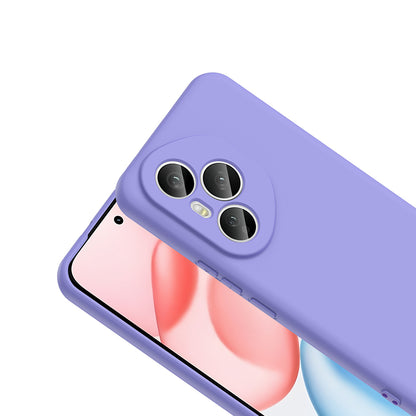 Honor 400 Pro Kılıf Zore Mara Lansman Kılıf