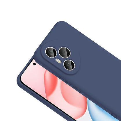 Honor 400 Pro Kılıf Zore Mara Lansman Kılıf