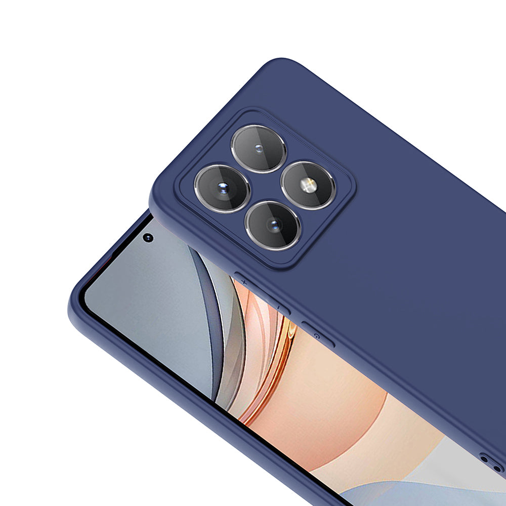 Xiaomi 14T Kılıf Zore Mara Lansman Kılıf