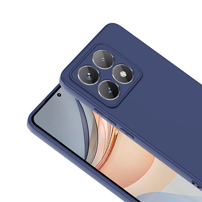 Xiaomi 14T Kılıf Zore Mara Lansman Kılıf